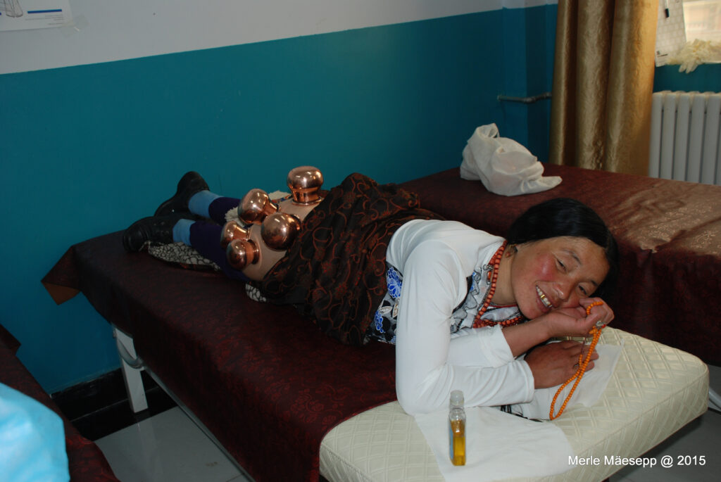 Ventouses Sowa Rigpa
