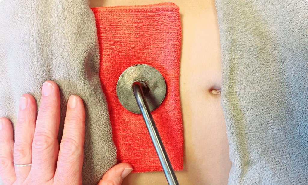 Moxibustion telmé