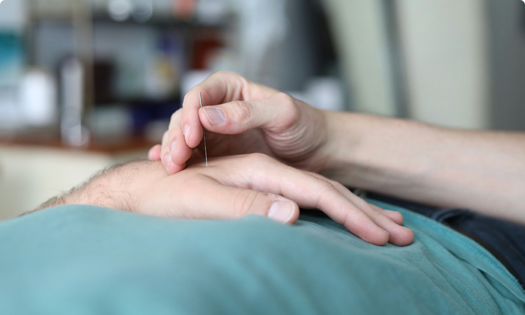 Moxibustion telmé